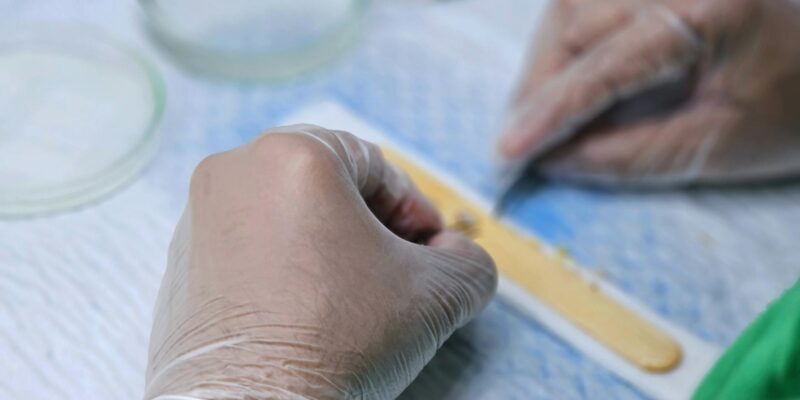 Gum Graft Cost: What to Budget in 2026