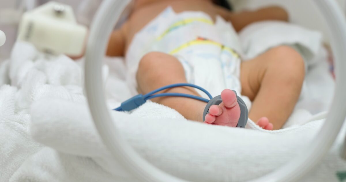 Neosure Formula: Essential Guide for Premature Baby Nutrition 2026