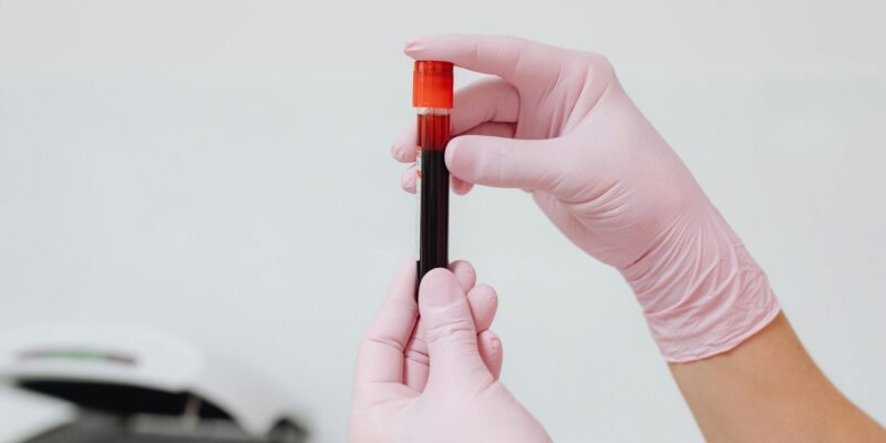 Treating Low Carbon Dioxide in Blood