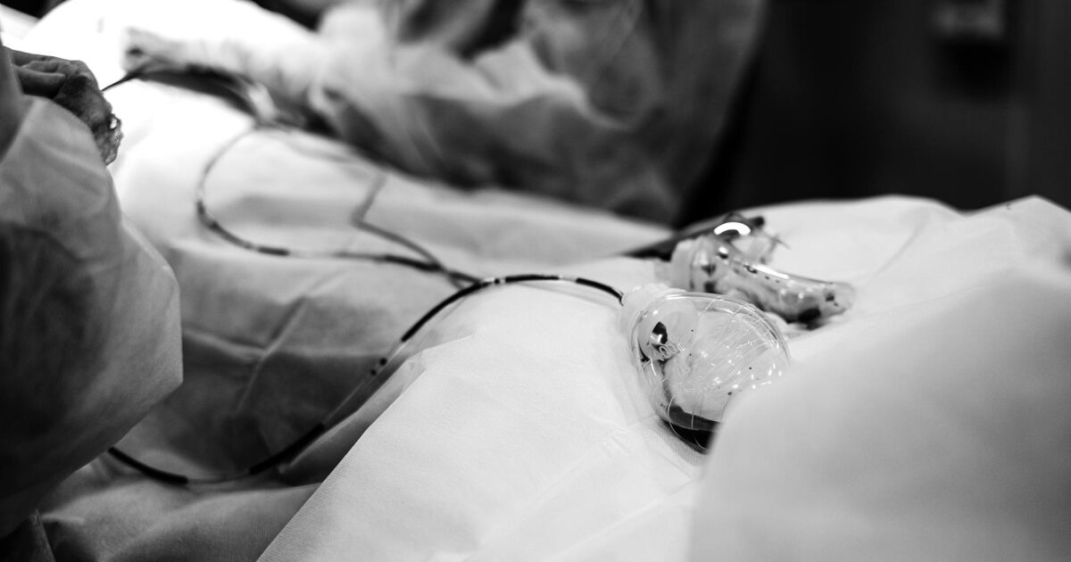 How Much Does a Vasectomy Cost in 2024?