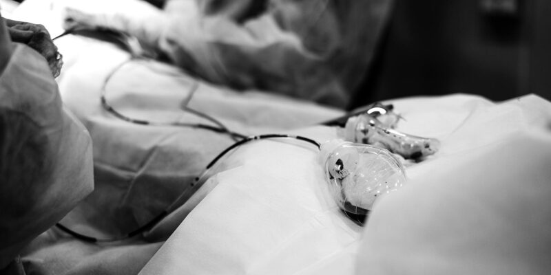 How Much Does a Vasectomy Cost in 2024?